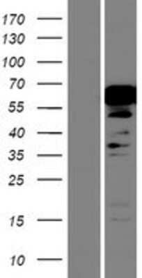 Western Blot: NKX2.3 Overexpression Lysate [NBP2-05494]