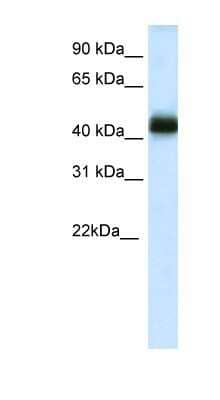 Western Blot: NKX2-4 Antibody [NBP1-91541]