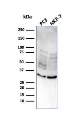 Western Blot: NKX2.8 Antibody (NKX28/2547) [NBP3-07611]