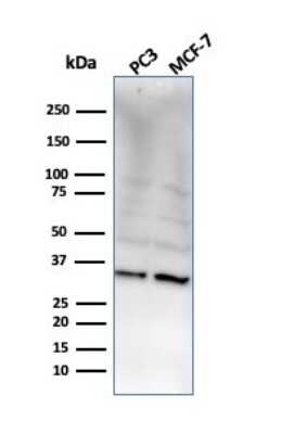 Western Blot: NKX2.8 Antibody (NKX28/2548) [NBP3-07636]