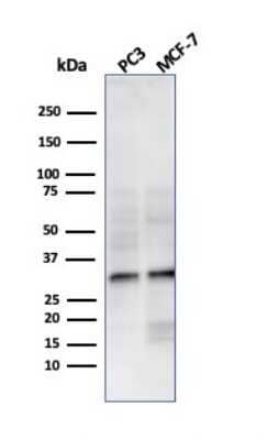 Western Blot: NKX2.8 Antibody (NKX28/3233R) [NBP3-07637]