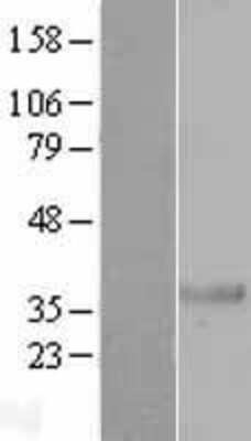 Western Blot: NKX2.8 Overexpression Lysate [NBP2-10327]