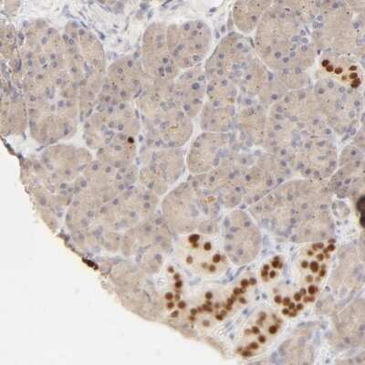 Immunohistochemistry-Paraffin: NKX2.2 Antibody [NBP1-82554]