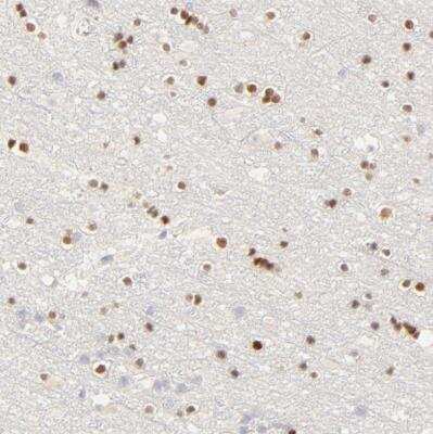Immunohistochemistry-Paraffin: NKX2.2 Antibody [NBP1-82554]
