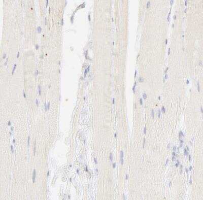 Immunohistochemistry-Paraffin: NKX2.2 Antibody [NBP1-82554]