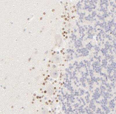 Immunohistochemistry-Paraffin: NKX2.2 Antibody [NBP1-82554]