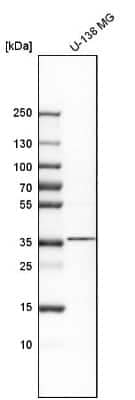 Western Blot: NKX2.2 Antibody [NBP1-82554]