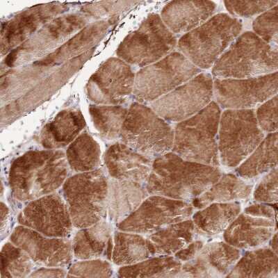 Immunohistochemistry-Paraffin: NKX2.3 Antibody [NBP2-13659]