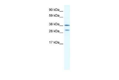 Western Blot: NKX2.3 Antibody [NBP2-85385]