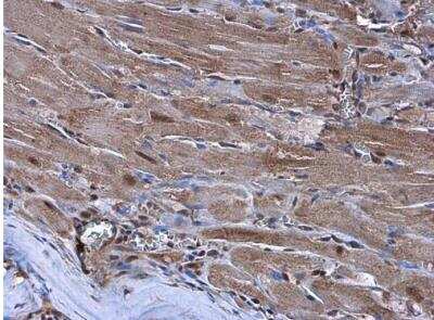 Immunohistochemistry-Paraffin: NKX2.5 Antibody [NBP1-31558]