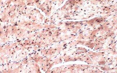 Immunohistochemistry-Paraffin: NKX2.5 Antibody [NBP1-31558]