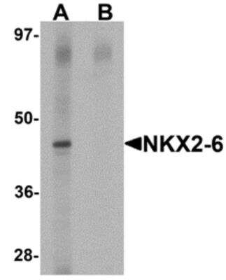 Western Blot: NKX2.6 AntibodyBSA Free [NBP2-41161]