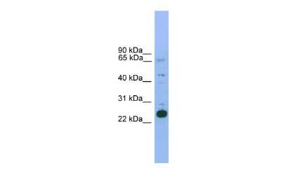 Western Blot: NKX2.6 Antibody [NBP3-10420]