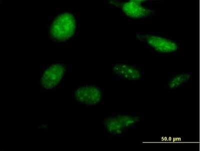 Immunocytochemistry/ Immunofluorescence: NKX2.8 Antibody [H00026257-B01P]