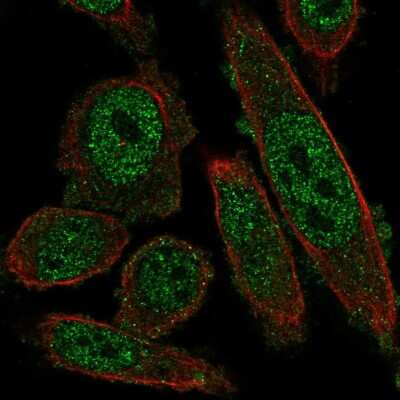 Immunocytochemistry/ Immunofluorescence: NKX2.8 Antibody [NBP2-34150]