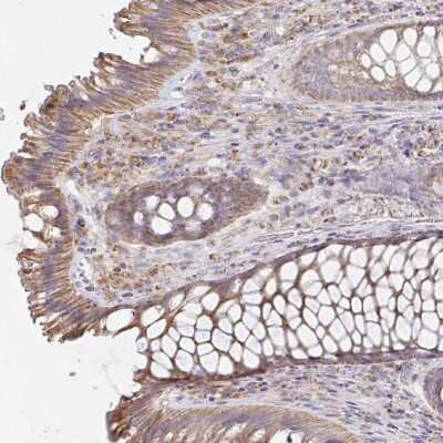 Immunohistochemistry-Paraffin: NKX2.8 Antibody [NBP2-34150]