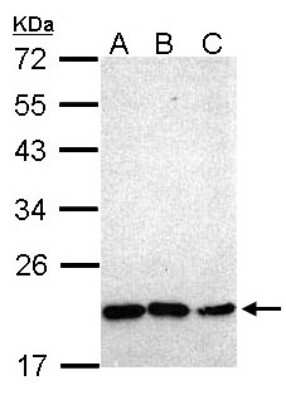 Western Blot: NKX2.8 Antibody [NBP1-31642]