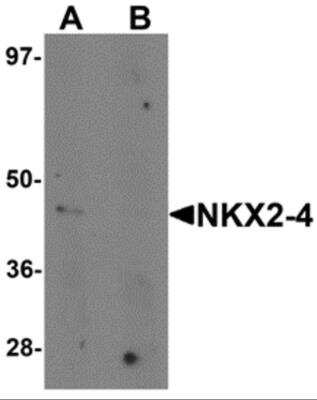 Western Blot: NKX2-4 AntibodyBSA Free [NBP2-81760]