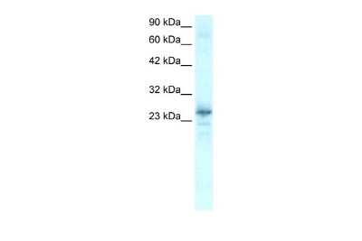 Western Blot: NKX2.8 Antibody [NBP2-87923]