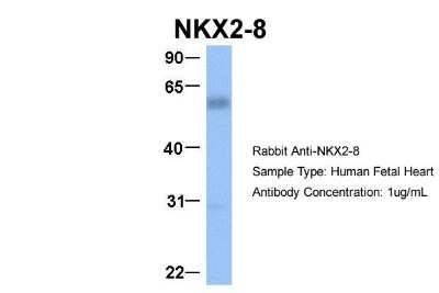 Western Blot: NKX2.8 Antibody [NBP2-87923]