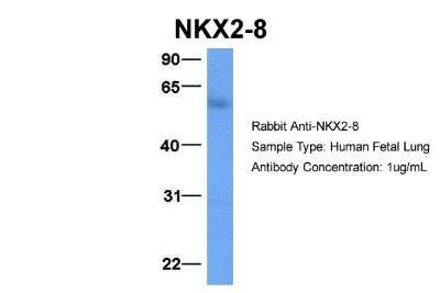 Western Blot: NKX2.8 Antibody [NBP2-87923]