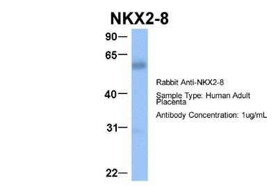 Western Blot: NKX2.8 Antibody [NBP2-87923]