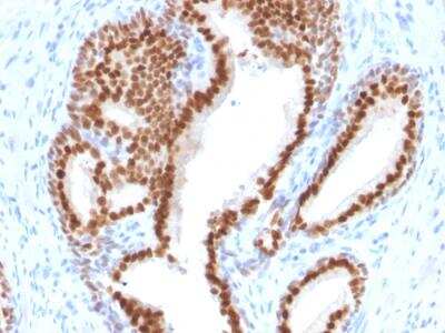 Immunohistochemistry-Paraffin: NKX3.1 Antibody (NKX3.1/2576) - Azide and BSA Free [NBP2-79871]
