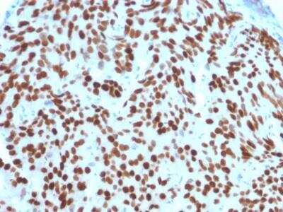 Immunohistochemistry-Paraffin: NKX3.1 Antibody (NKX3.1/2576) - Azide and BSA Free [NBP2-79871]