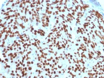 Immunohistochemistry-Paraffin: NKX3.1 Antibody (NKX3.1/2576) [NBP2-79736]