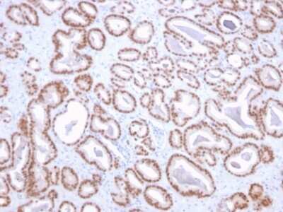 Immunohistochemistry-Paraffin: NKX3.1 Antibody (NKX3.1/2836) [NBP3-07435]