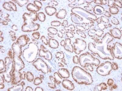 Immunohistochemistry-Paraffin: NKX3.1 Antibody (NKX3.1/2836) - Azide and BSA Free [NBP3-08677]