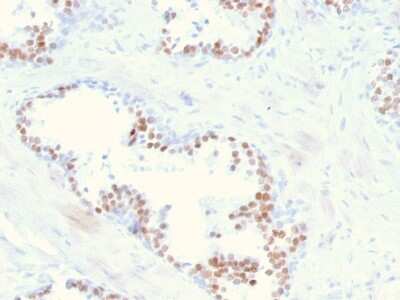 Immunohistochemistry-Paraffin: NKX3.1 Antibody (NKX3.1/2836) - Azide and BSA Free [NBP3-08677]