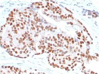 Immunohistochemistry-Paraffin: NKX3.1 Antibody (NKX3.1/3347) - Azide and BSA Free [NBP3-08678]