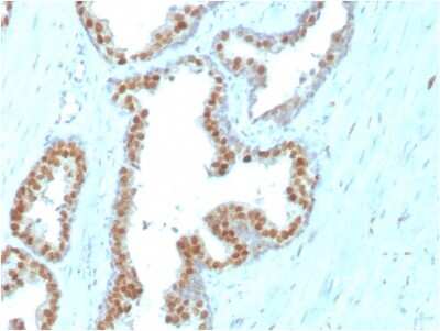Immunohistochemistry-Paraffin: NKX3.1 Antibody (NKX3.1/3347) - Azide and BSA Free [NBP3-08678]
