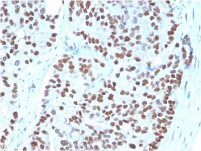 Immunohistochemistry-Paraffin: NKX3.1 Antibody (NKX3.1/3348) [NBP3-07437]