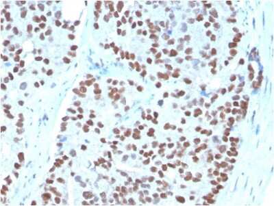 Immunohistochemistry-Paraffin: NKX3.1 Antibody (NKX3.1/3348) - Azide and BSA Free [NBP3-08682]