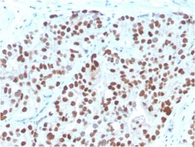 Immunohistochemistry-Paraffin: NKX3.1 Antibody (NKX3.1/3348) - Azide and BSA Free [NBP3-08682]