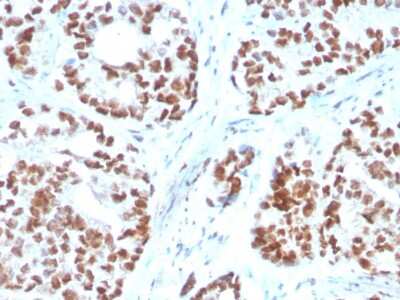 Immunohistochemistry-Paraffin: NKX3.1 Antibody (NKX3.1/3350) [NBP3-07411]