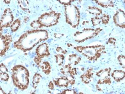 Immunohistochemistry-Paraffin: NKX3.1 Antibody (NKX3.1/4562R) - Azide and BSA Free [NBP3-08744]