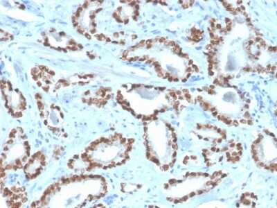 Immunohistochemistry-Paraffin: NKX3.1 Antibody (NKX3.1/4562R) [NBP3-07447]