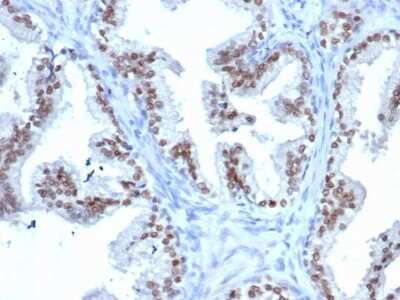 Immunohistochemistry-Paraffin: NKX3.1 Antibody (rNKX3.1/6620) - Azide and BSA Free [NBP3-08573]