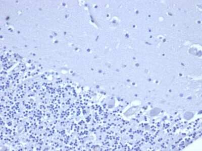 Immunohistochemistry-Paraffin: NKX3.1 Antibody (rNKX3.1/6620) - Azide and BSA Free [NBP3-08573]