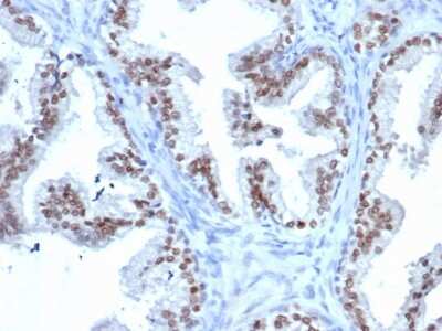Immunohistochemistry-Paraffin: NKX3.1 Antibody (rNKX3.1/6620) [NBP3-07412]