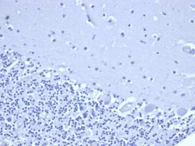 Immunohistochemistry-Paraffin: NKX3.1 Antibody (rNKX3.1/6620) [NBP3-07412]