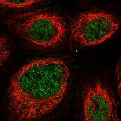 Immunocytochemistry/ Immunofluorescence: NKX3-2 Antibody [NBP1-88708]