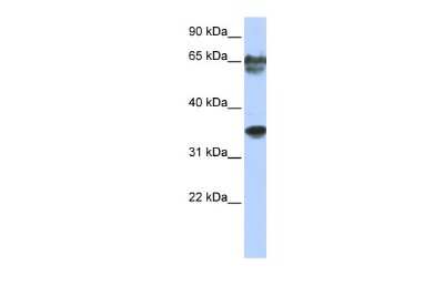 Western Blot: NKX3-2 Antibody [NBP2-87924]