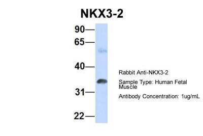 Western Blot: NKX3-2 Antibody [NBP2-87924]