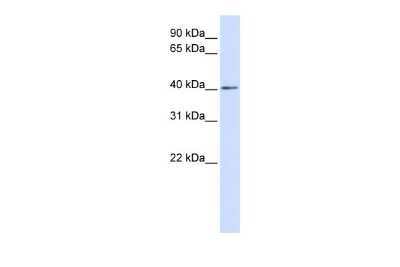 Western Blot: NKX3-2 Antibody [NBP2-87927]