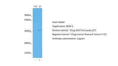 Western Blot: NKX3-2 Antibody [NBP2-87927]