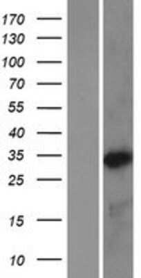 Western Blot: NKX3-2 Overexpression Lysate [NBP2-10960]